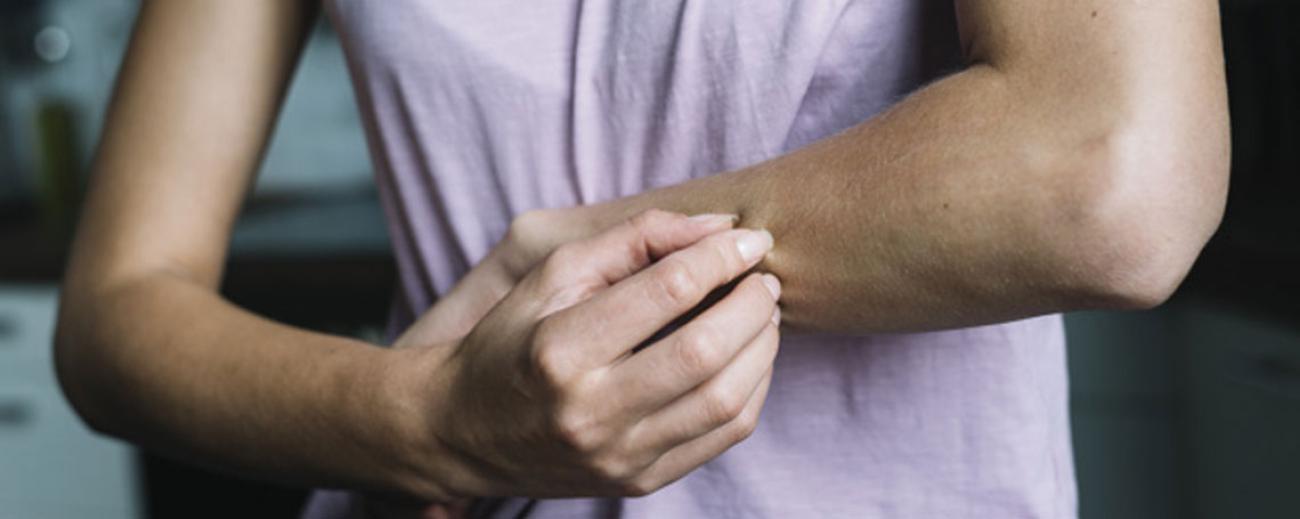 La psoriasis puede aparecer en cualquier parte del cuerpo como los brazos, la espalda, las piernas e incluso los párpados y uñas.Foto: Freepik