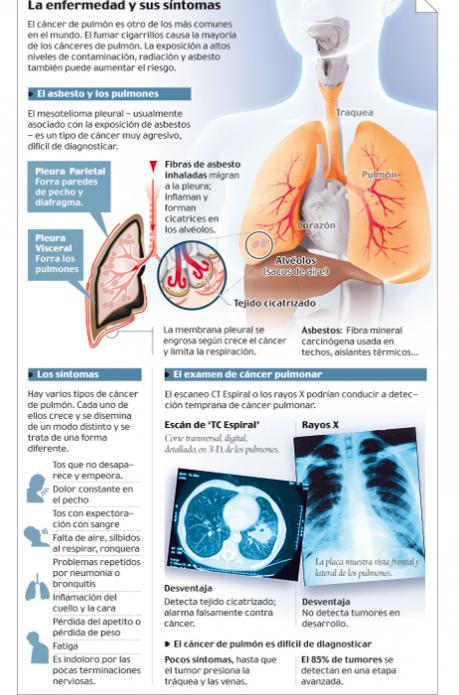 Info cáncer pulmón