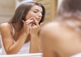 El acné puede causar enrojecimiento y picazón en la piel. Foto: Freepick